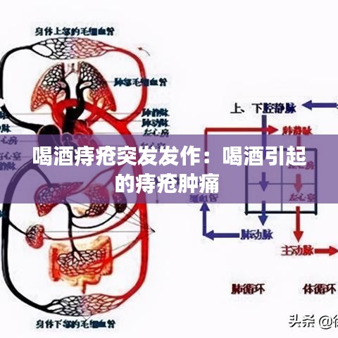 喝酒痔疮突发发作：喝酒引起的痔疮肿痛 