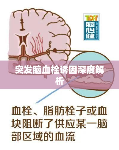 突发脑血栓诱因深度解析