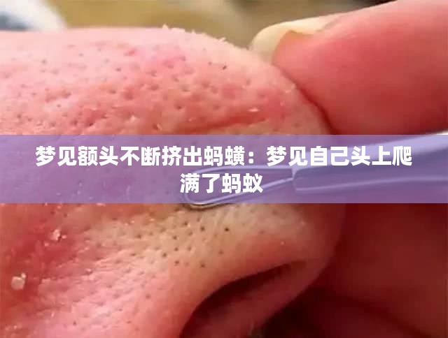 梦见额头不断挤出蚂蟥:梦见自己头上爬满了蚂蚁