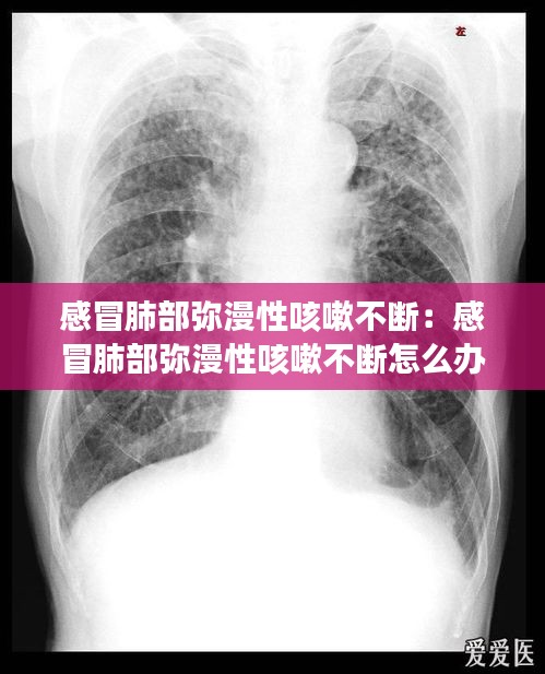 感冒肺部弥漫性咳嗽不断：感冒肺部弥漫性咳嗽不断怎么办 