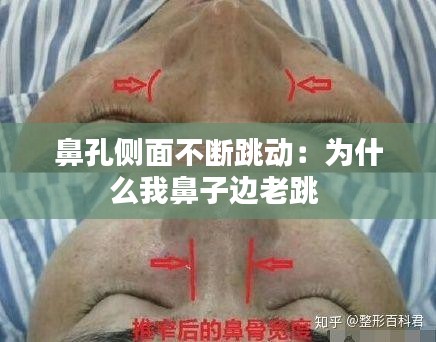 鼻孔侧面不断跳动：为什么我鼻子边老跳 