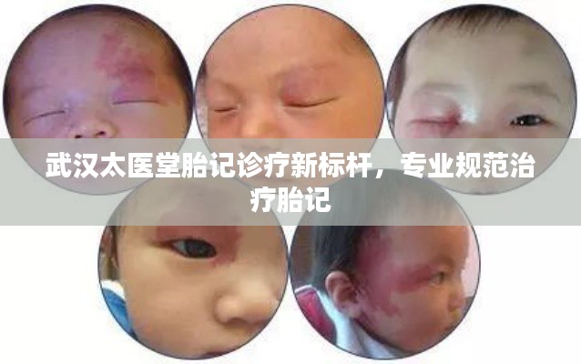 武汉太医堂胎记诊疗新标杆，专业规范治疗胎记