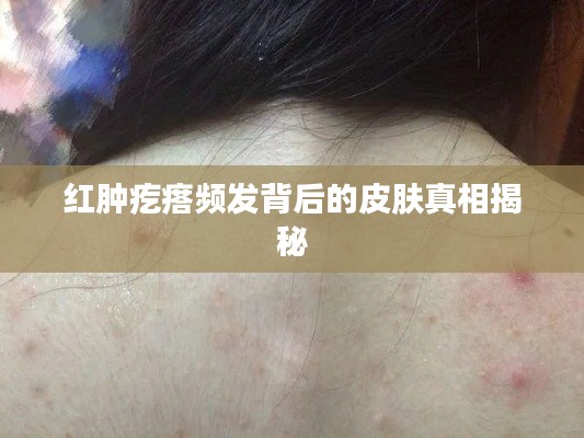 红肿疙瘩频发背后的皮肤真相揭秘