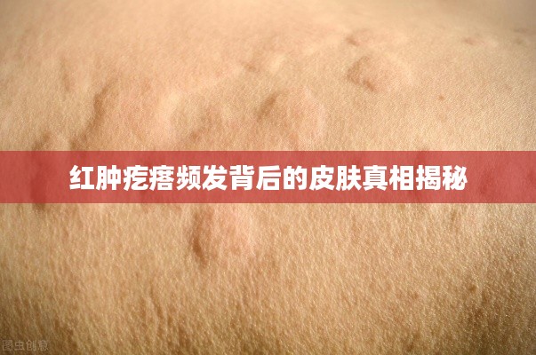 红肿疙瘩频发背后的皮肤真相揭秘