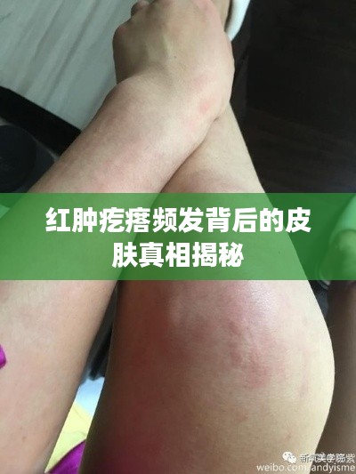 红肿疙瘩频发背后的皮肤真相揭秘
